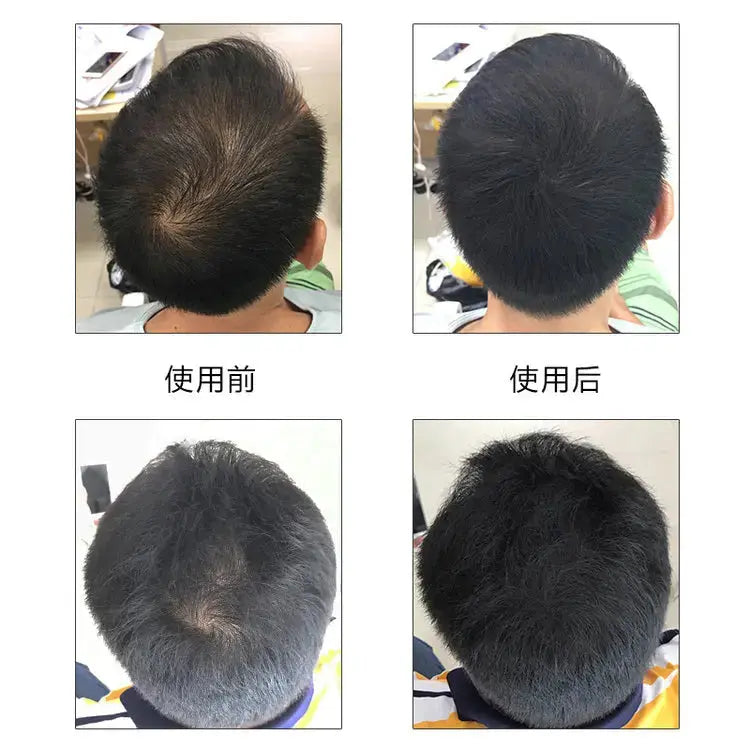 Kingyes Hair Fiber Spray My Store